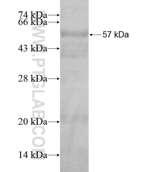 AMH fusion protein Ag20110 SDS-PAGE AMH fusion protein Ag20110 SDS-PAGE