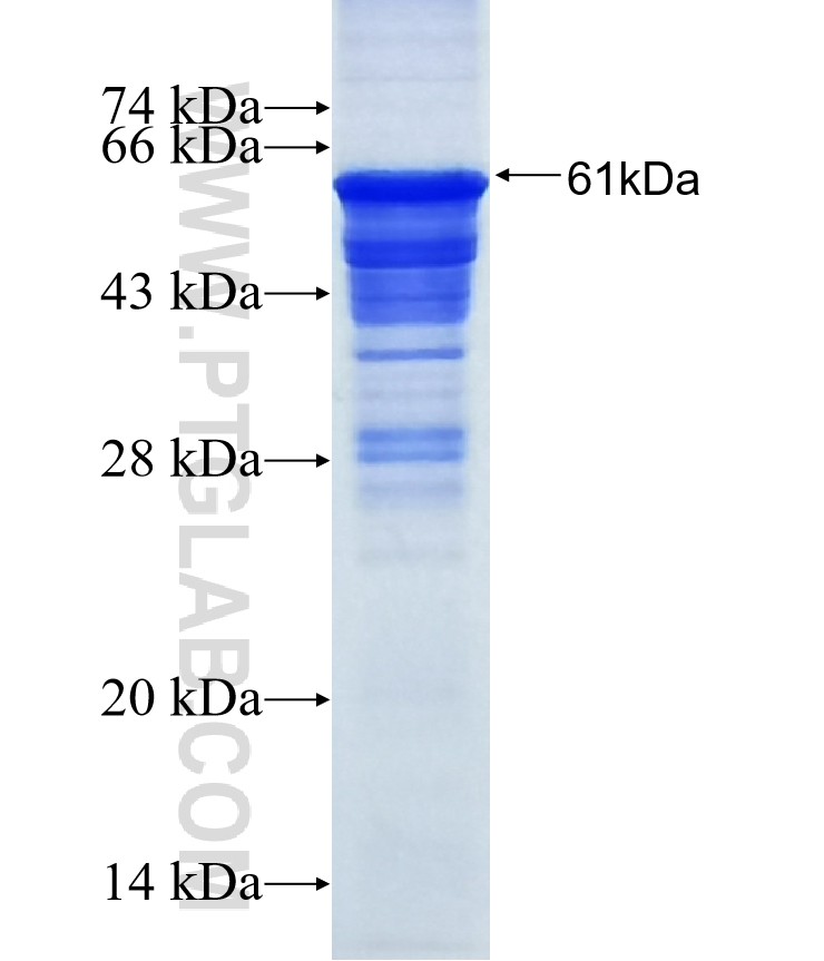AMHR2 fusion protein Ag22473 SDS-PAGE