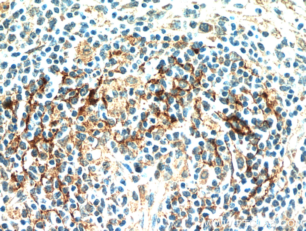 IHC staining of human spleen using 21302-1-AP