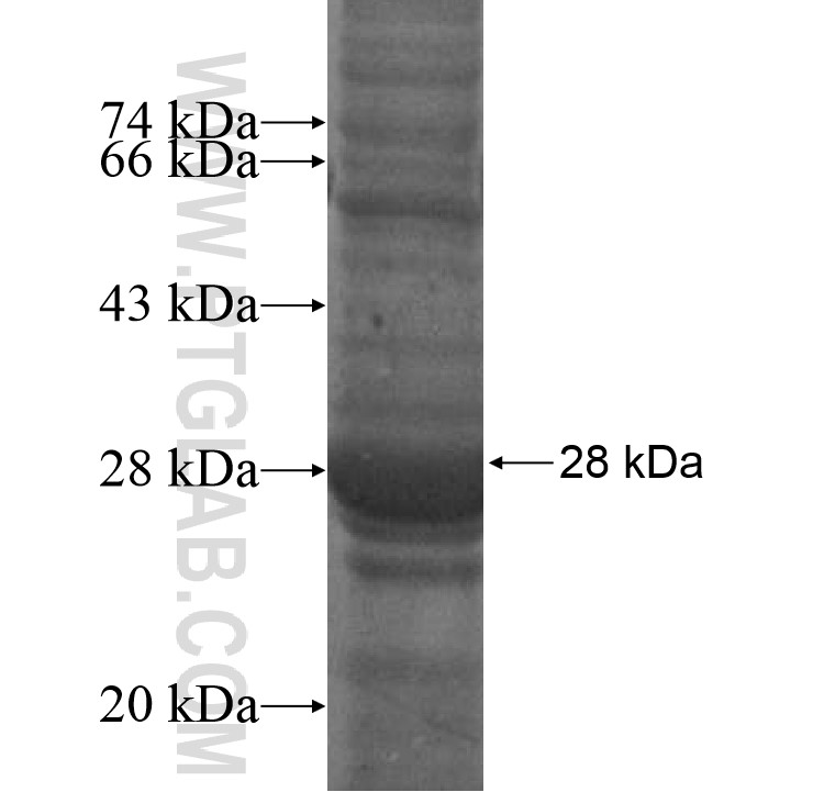 AMICA1 fusion protein Ag16763 SDS-PAGE AMICA1 fusion protein Ag16763 SDS-PAGE