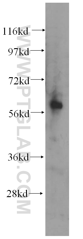 WB analysis of Y79 using 14076-1-AP