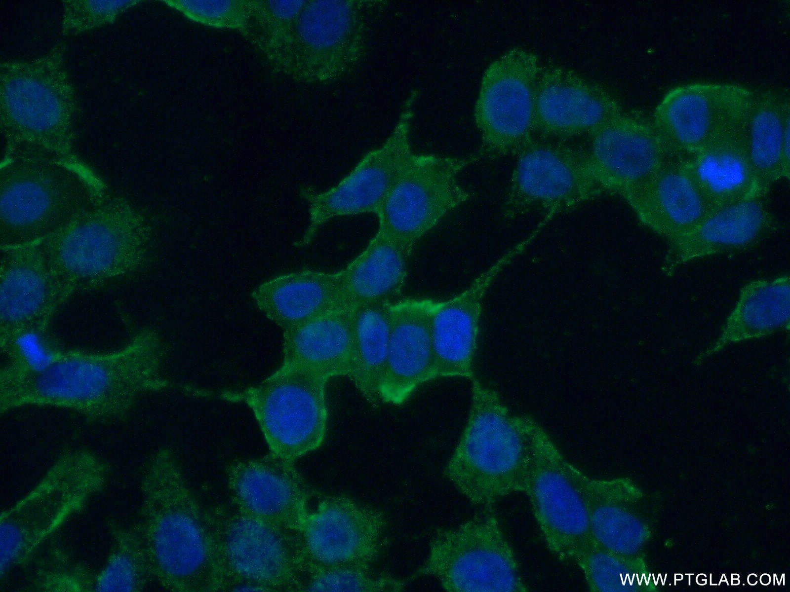 IF Staining of MCF-7 using 21278-1-AP (same clone as 21278-1-PBS)