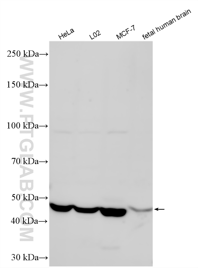 Various lysates were subjected to SDS PAGE followed by western blot with 21278-1-AP (AMIGO3 antibody) at dilution of 1:2000 incubated at room temperature for 1.5 hours. WB analysis using 21278-1-AP