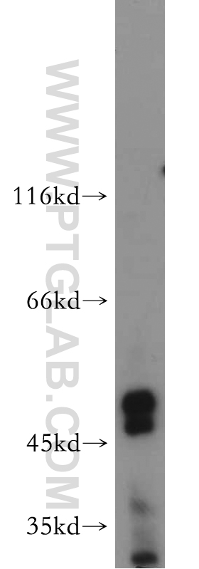 WB analysis of MCF-7 using 21278-1-AP