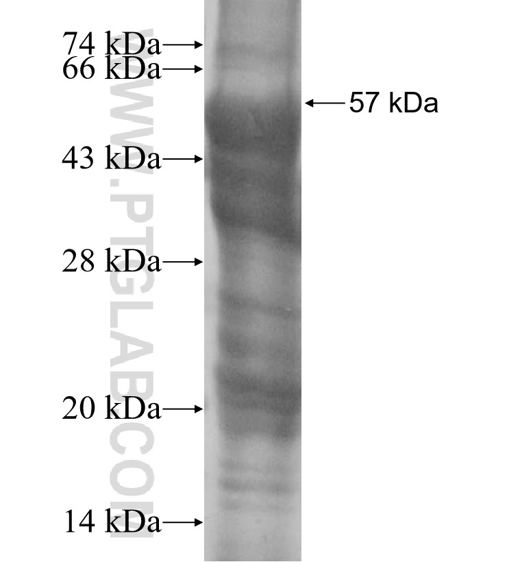 AMIGO3 fusion protein Ag15790 SDS-PAGE