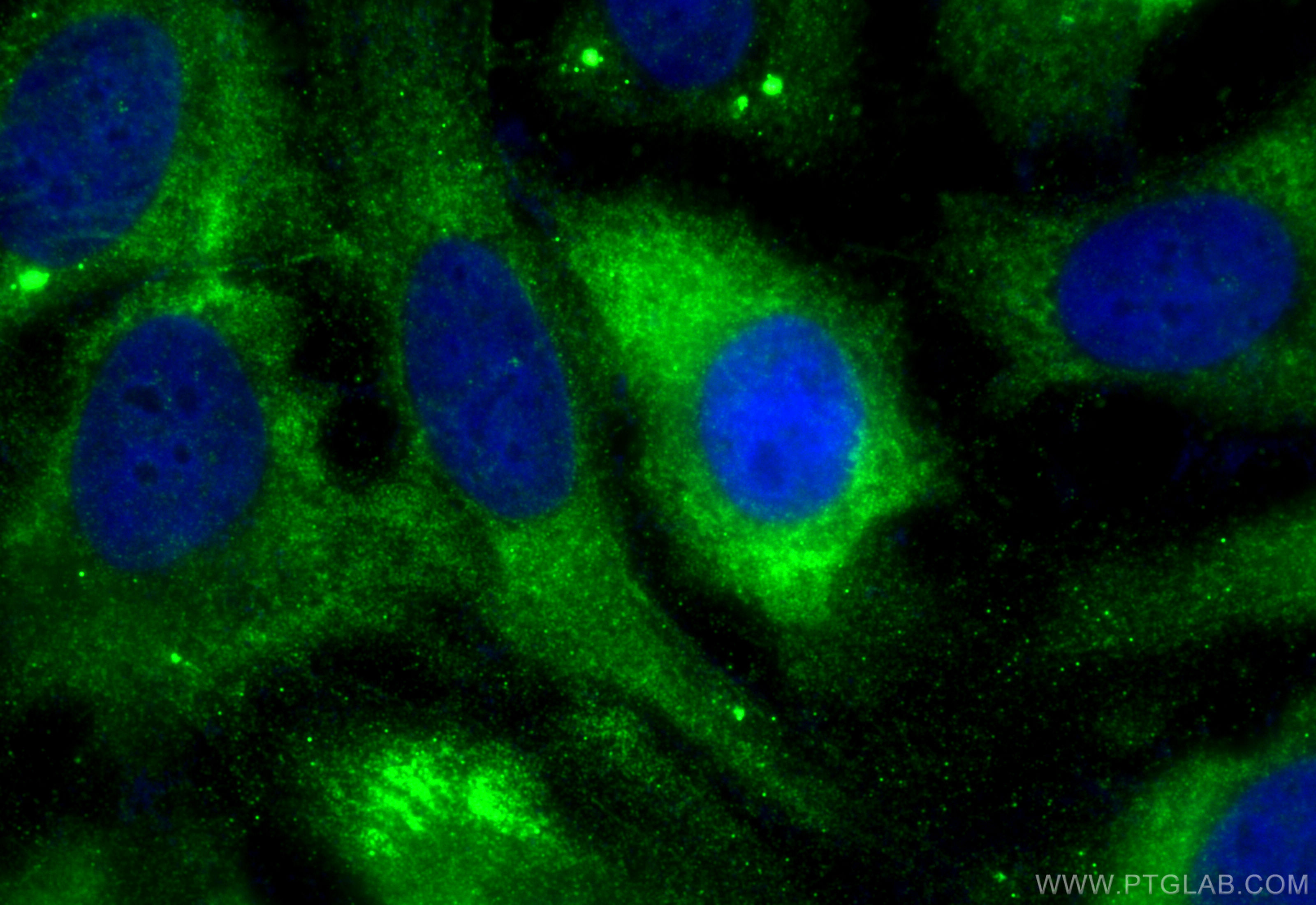 IF Staining of HeLa using 32038-1-AP