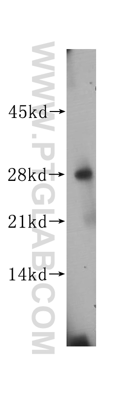 WB analysis of human colon using 14694-1-AP