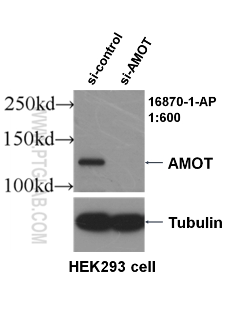 WB analysis of HEK-293 using 16870-1-AP