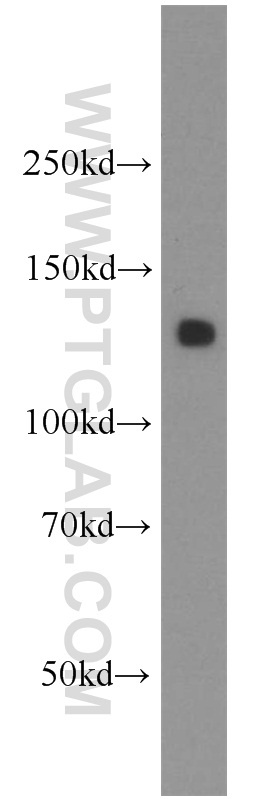 WB analysis of human stomach using 16870-1-AP