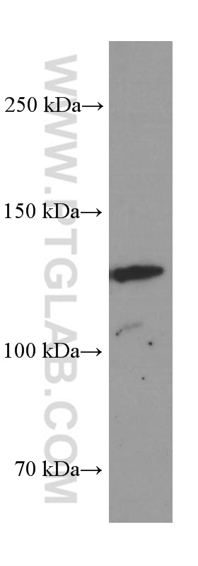 WB analysis of SGC-7901 using 60156-1-Ig