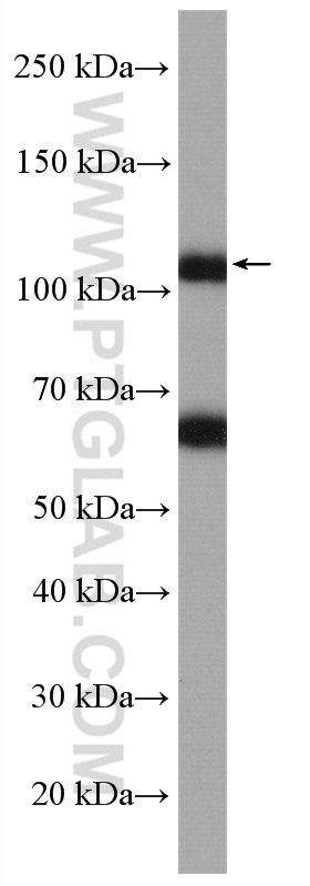 AMOTL2