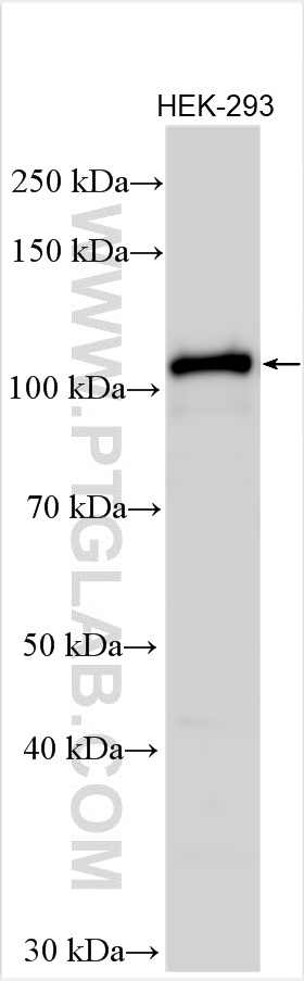 WB analysis using 23351-1-AP