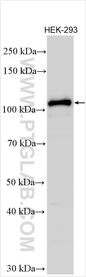 WB analysis using 23351-1-AP