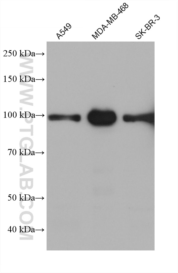 WB analysis using 68401-1-Ig