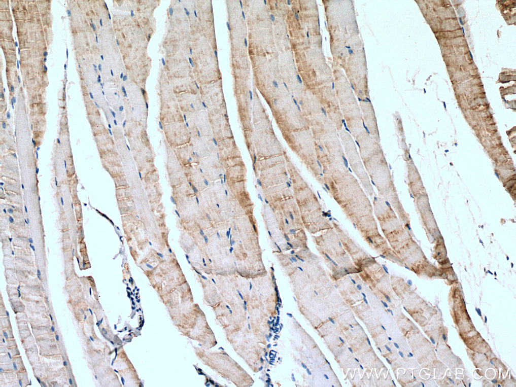 IHC staining of mouse skeletal muscle using 19780-1-AP