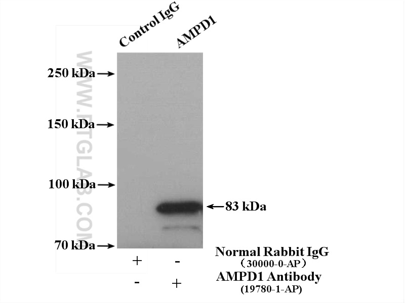 IP experiment of mouse skeletal muscle using 19780-1-AP