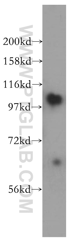 WB analysis of human liver using 15710-1-AP