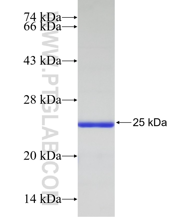 AMPD3 fusion protein Ag33050 SDS-PAGE AMPD3 fusion protein Ag33050 SDS-PAGE