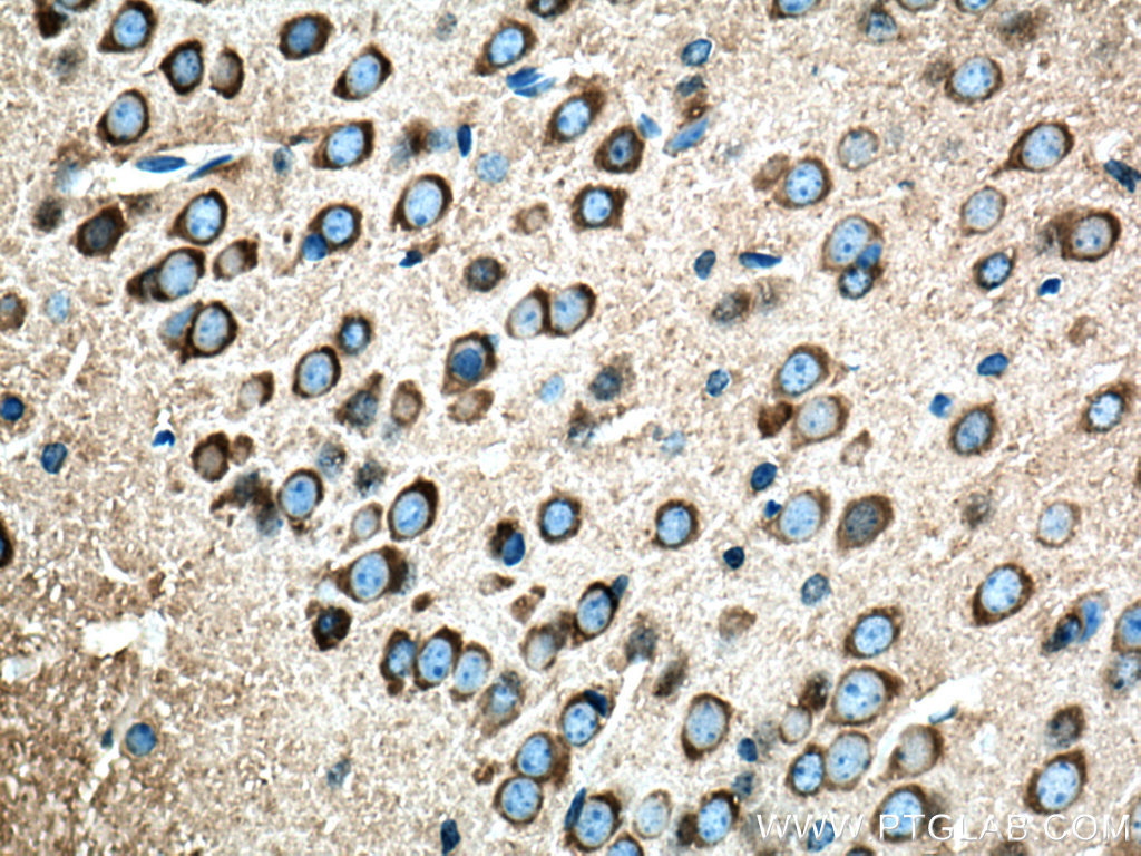 IHC staining of mouse brain using 13379-1-AP