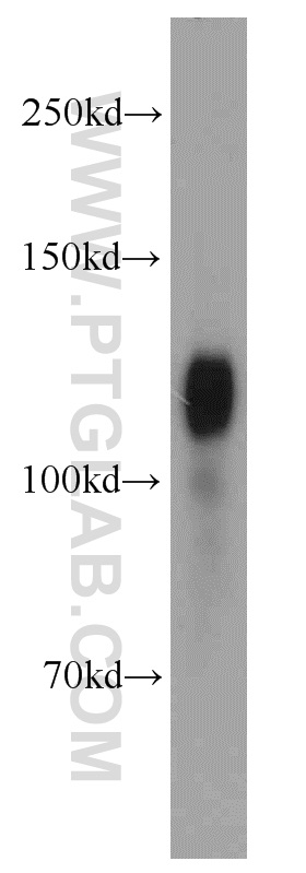 WB analysis of mouse brain using 13379-1-AP