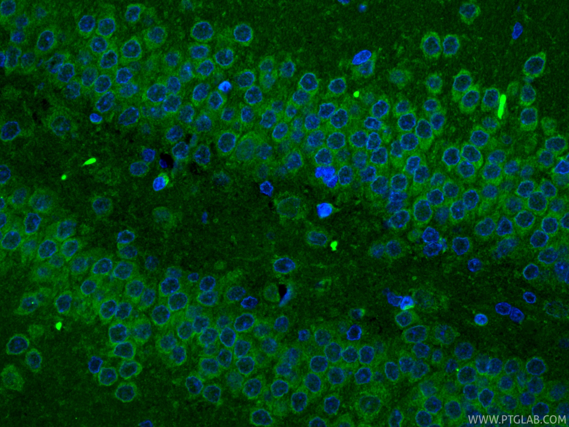 Immunofluorescent analysis of (4% PFA) fixed paraffin-embedded rat brain tissue using CoraLite® Plus 488 AMPK Alpha antibody (CL488-80209-5, Clone: 4N5 ) at dilution of 1:200. Heat mediated antigen retrieval with Tris-EDTA buffer (pH 9.0). IF Staining of rat brain using CL488-80209-5