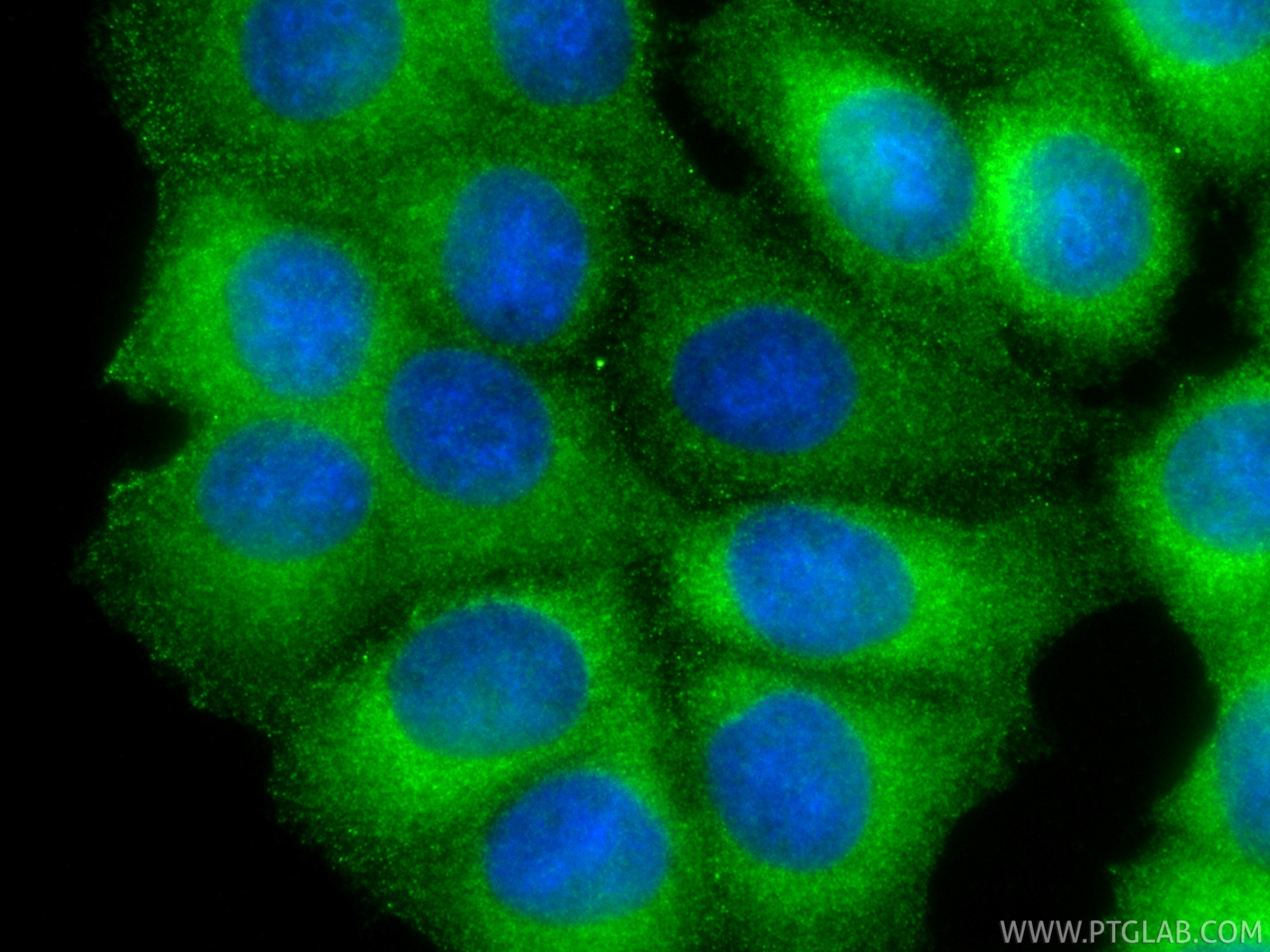 IF Staining of MCF-7 using 88497-1-RR