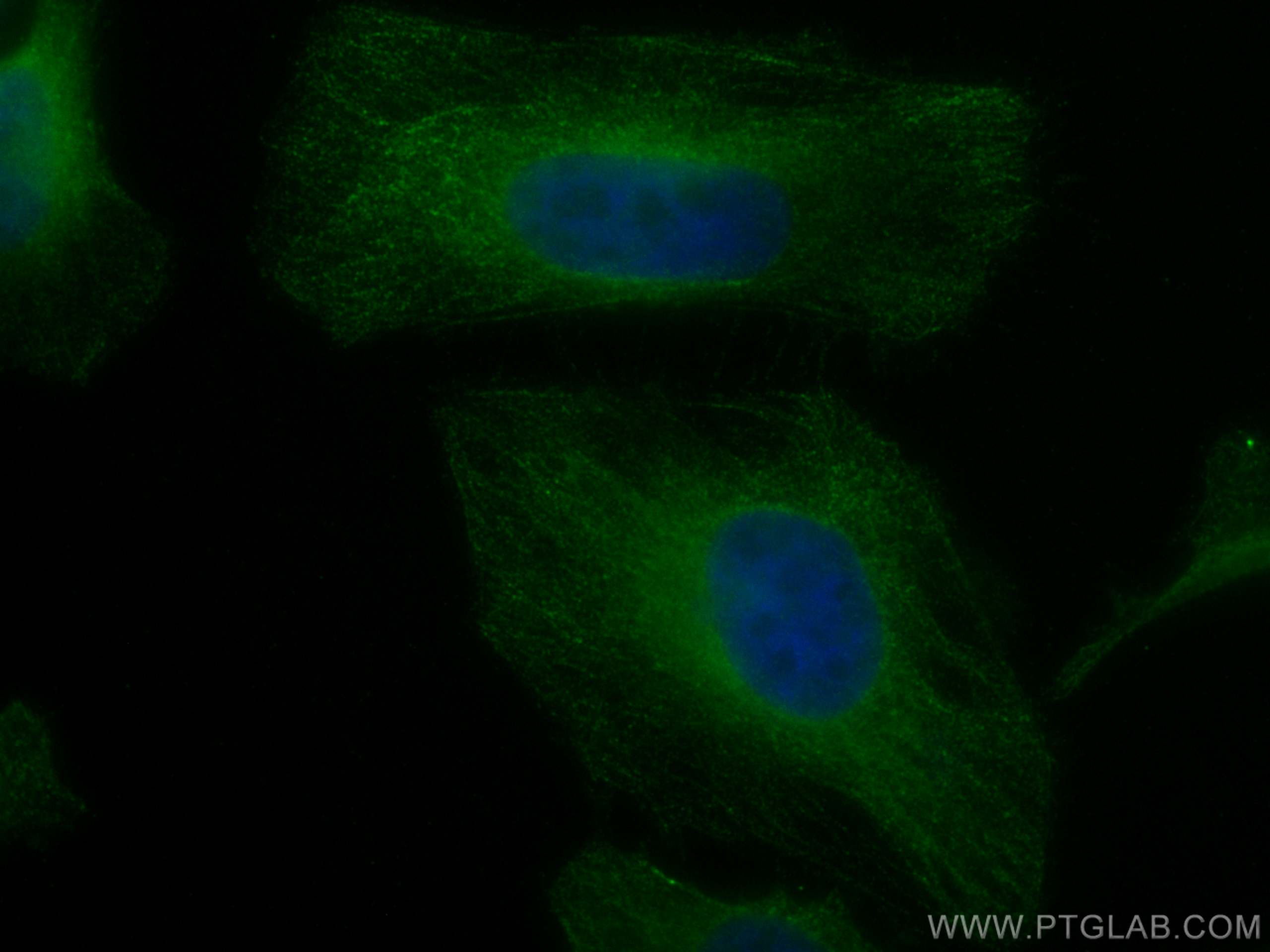 IF Staining of HeLa using CL488-66579