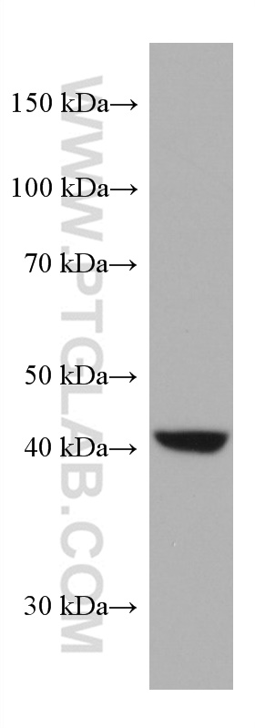 WB analysis of pig liver using 67532-1-Ig (same clone as 67532-1-PBS)