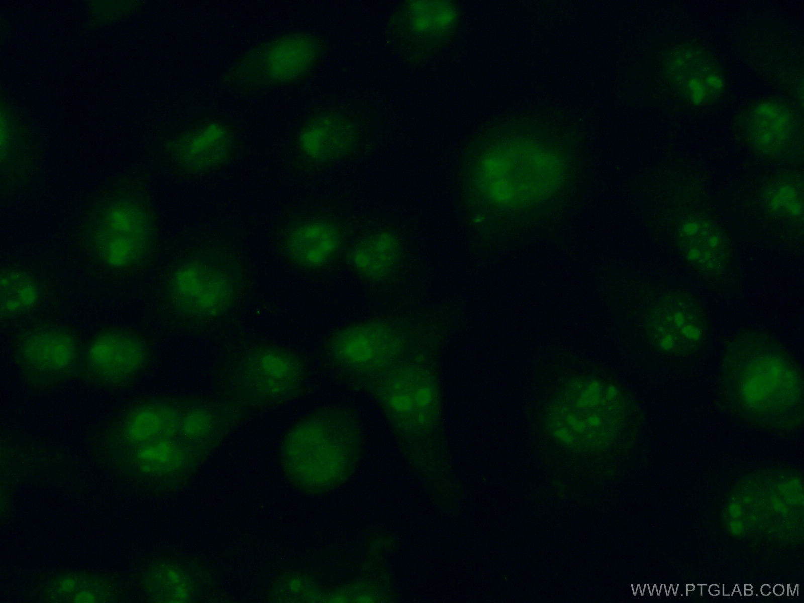 IF Staining of A431 using 24463-1-AP