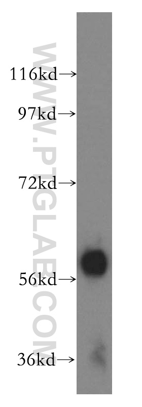 WB analysis of human liver using 15845-1-AP