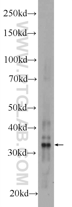 WB analysis of mouse liver using 24484-1-AP