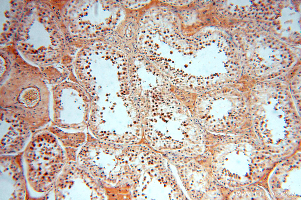 IHC staining of human testis using 16664-1-AP