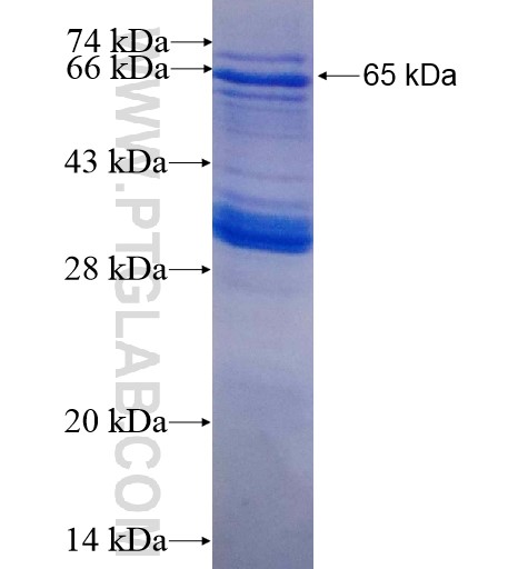 AMZ2 fusion protein Ag10141 SDS-PAGE