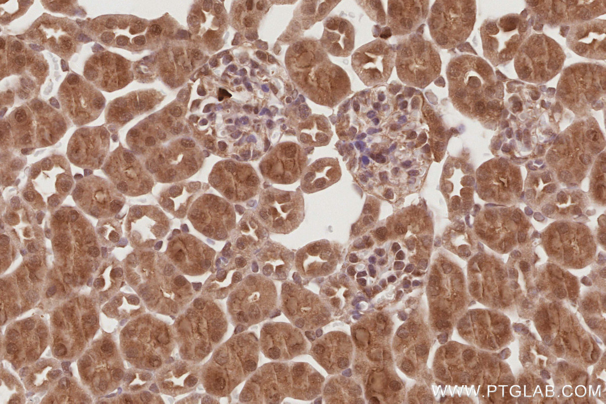 IHC staining of mouse kidney using 21748-1-AP