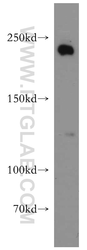WB analysis of HeLa using 21748-1-AP