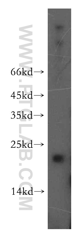 WB analysis of mouse pancreas using 15065-1-AP