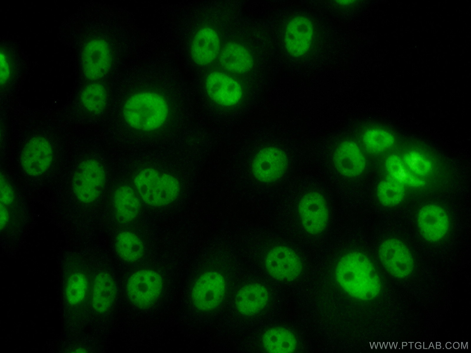 IF Staining of MCF-7 using 13559-1-AP