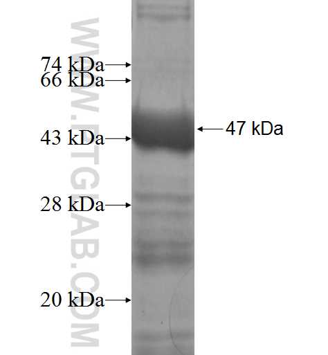ANAPC4 fusion protein Ag5358 SDS-PAGE ANAPC4 fusion protein Ag5358 SDS-PAGE