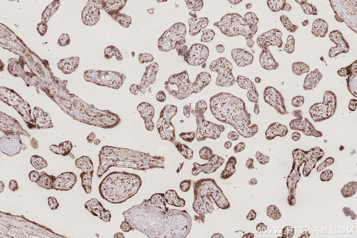 IHC staining of human placenta using 67348-1-Ig IHC staining of human placenta using 67348-1-Ig