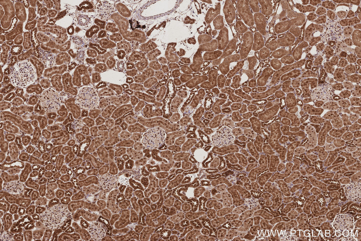 IHC staining of rat kidney using 67348-1-Ig IHC staining of rat kidney using 67348-1-Ig