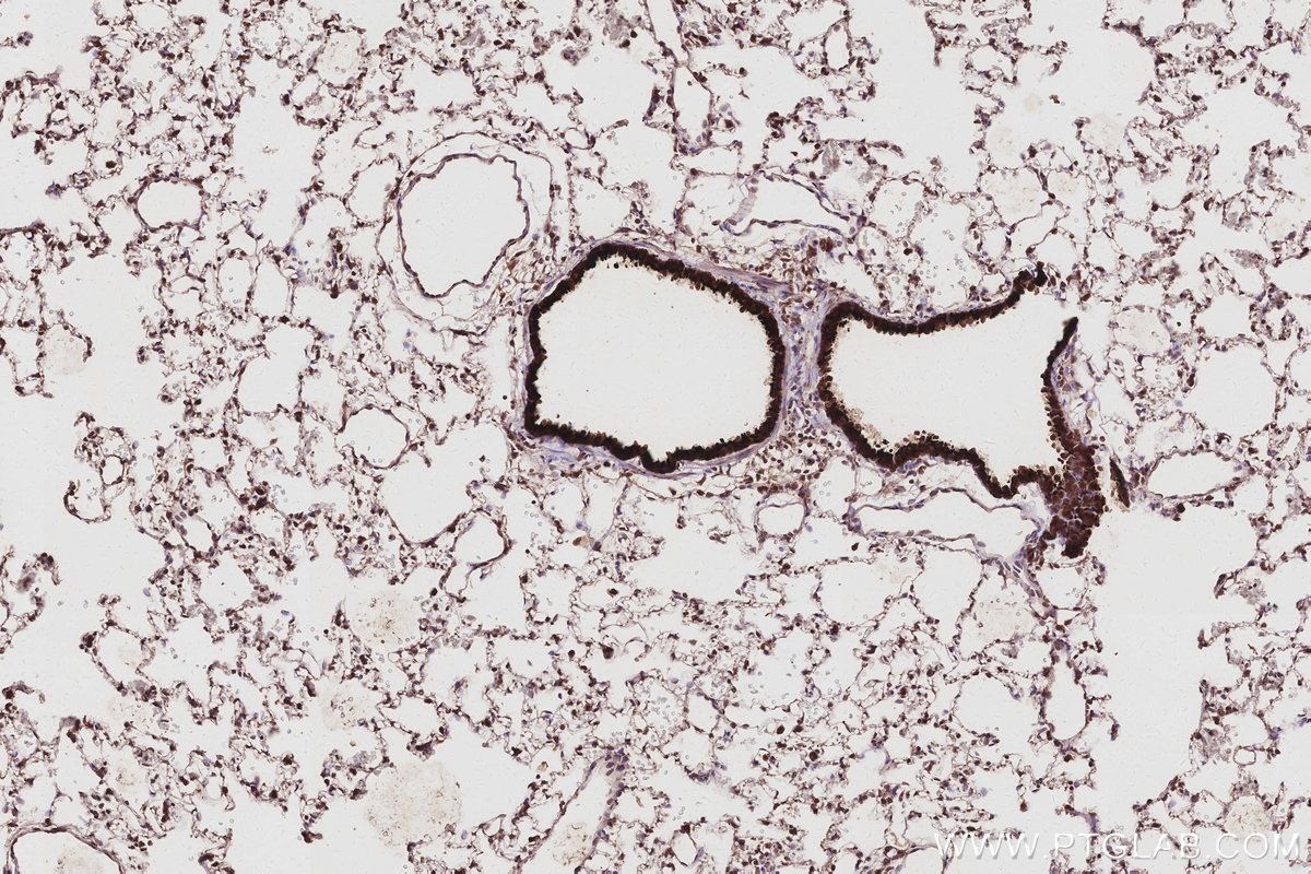 IHC staining of rat lung using 67348-1-Ig IHC staining of rat lung using 67348-1-Ig