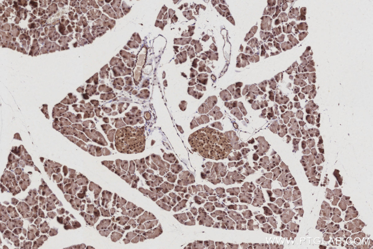 IHC staining of mouse pancreas using 21761-1-AP IHC staining of mouse pancreas using 21761-1-AP