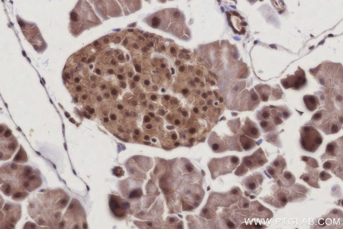 IHC staining of mouse pancreas using 21761-1-AP