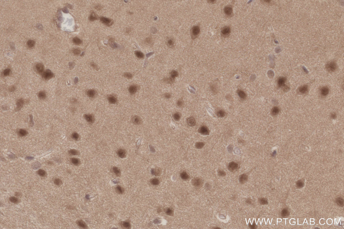 IHC staining of rat brain using 21761-1-AP IHC staining of rat brain using 21761-1-AP