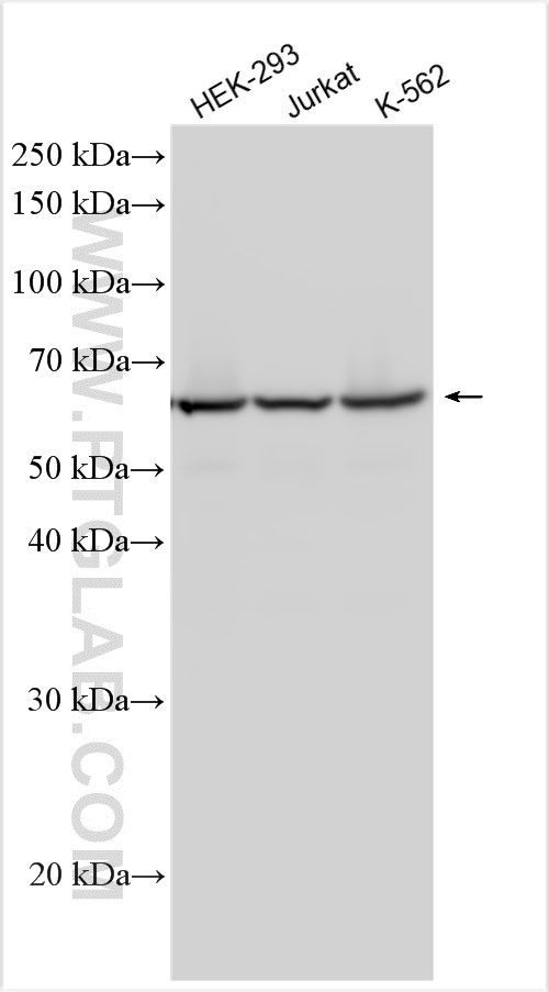 WB analysis using 21761-1-AP
