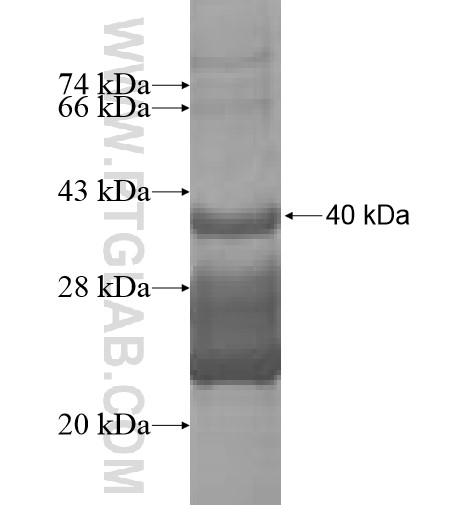 ANG fusion protein Ag10120 SDS-PAGE