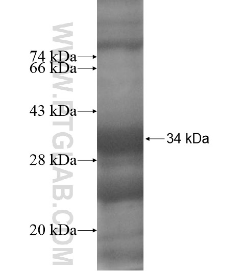 ANGEL2 fusion protein Ag11636 SDS-PAGE ANGEL2 fusion protein Ag11636 SDS-PAGE