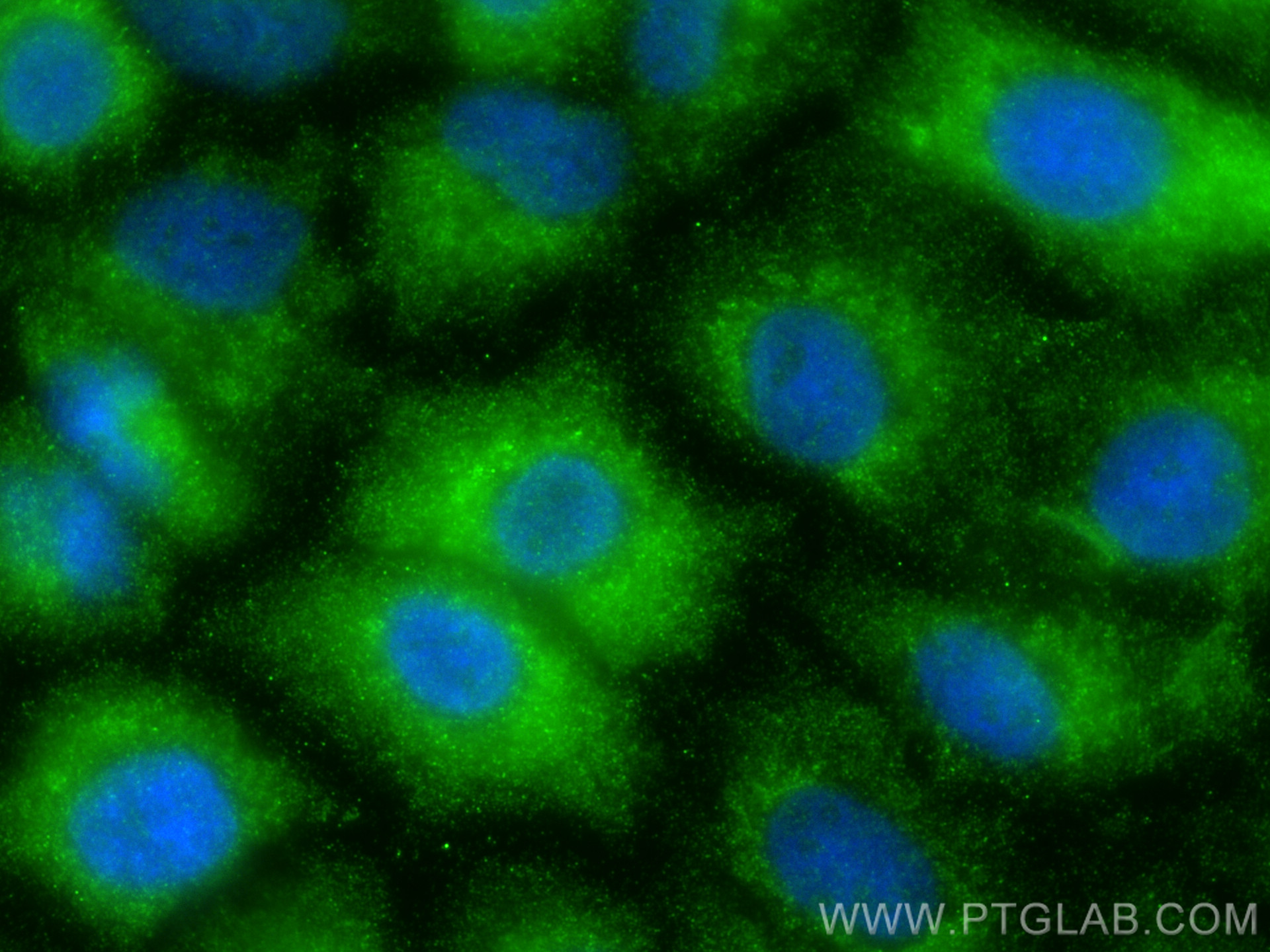 IF Staining of A549 using 24613-1-AP