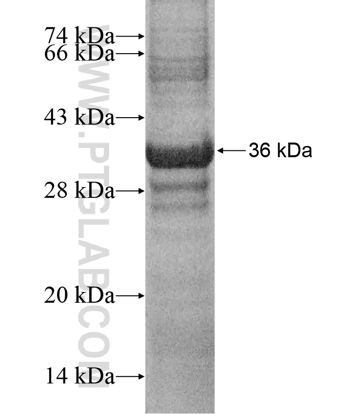 ANGPT2 fusion protein Ag17938 SDS-PAGE