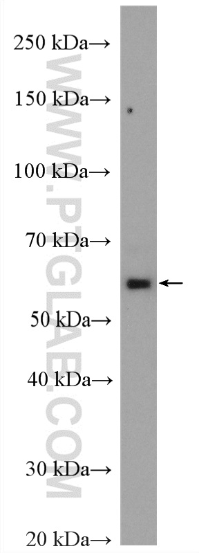 WB analysis of mouse heart using 12316-1-AP